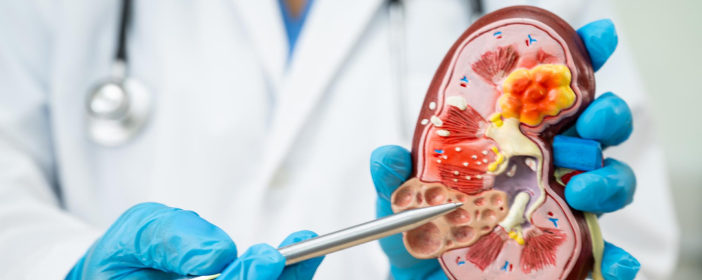 Nephrology at JP Hospital